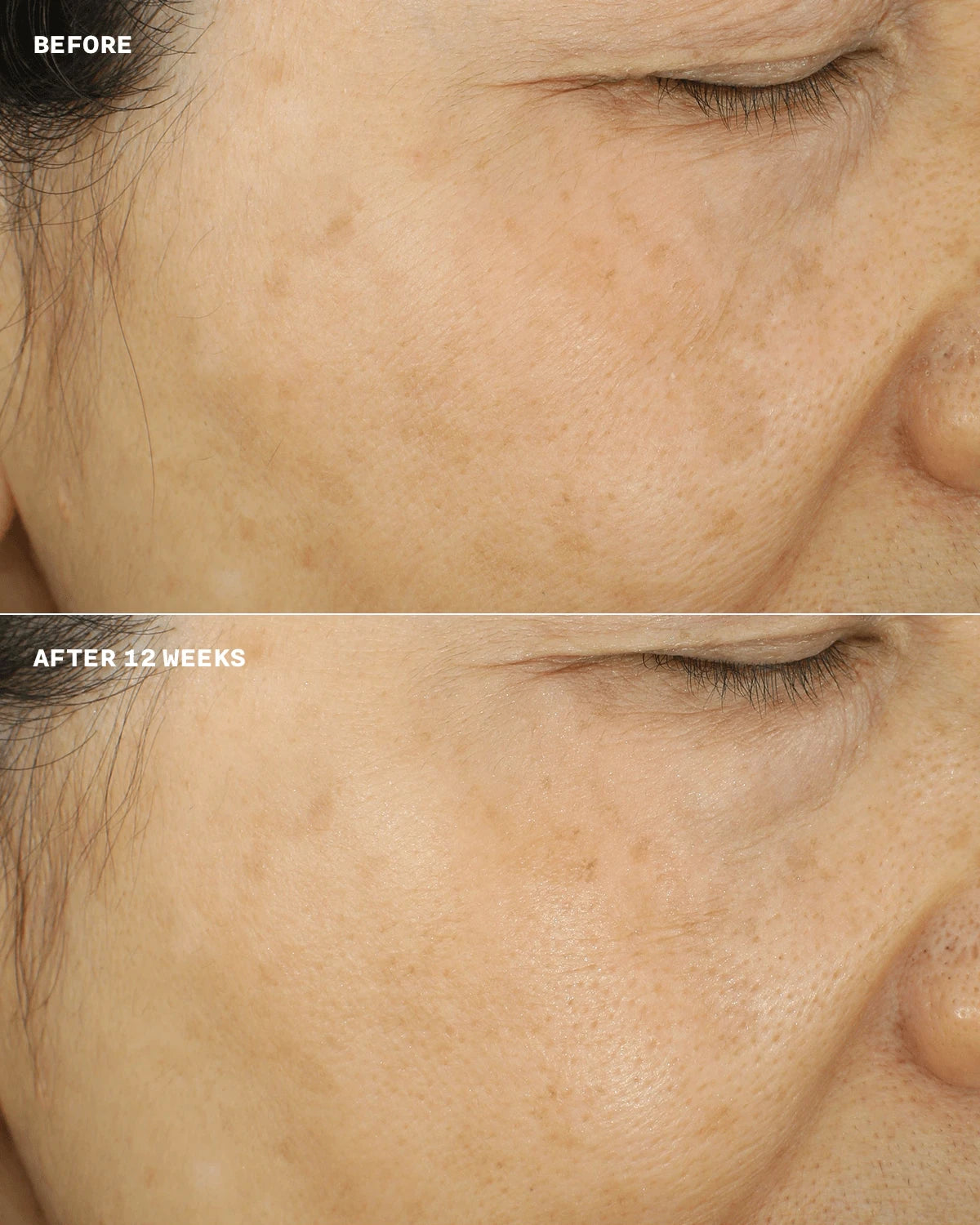 Even Better™ Brightening Essence Lotion - US 4765