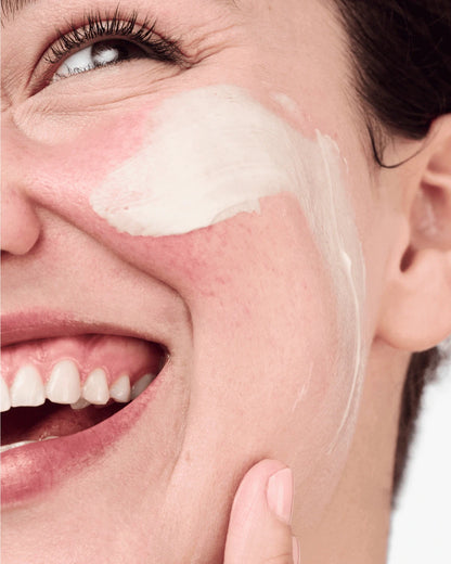 Redness Relief Kit - US 9343