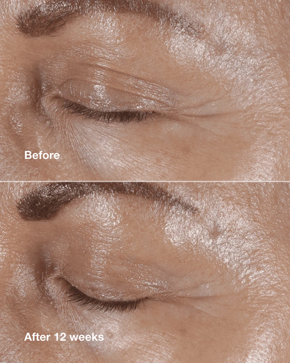 Anti-Aging Routine: Mini Smart Clinical Repair Kit - US 3094
