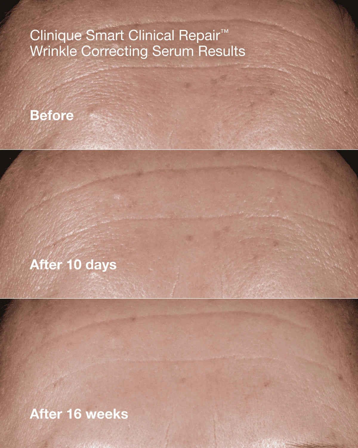 Anti-Aging Routine Skincare Set - US 3745