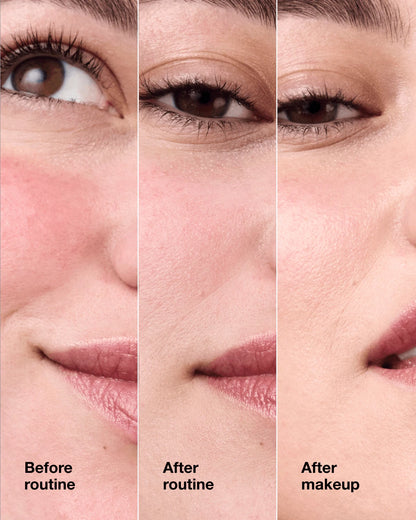 Redness Solutions Makeup Broad Spectrum SPF 15 With Probiotic Technology - US 9567