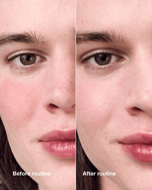 Redness Solutions Redness Regimen - US 7613