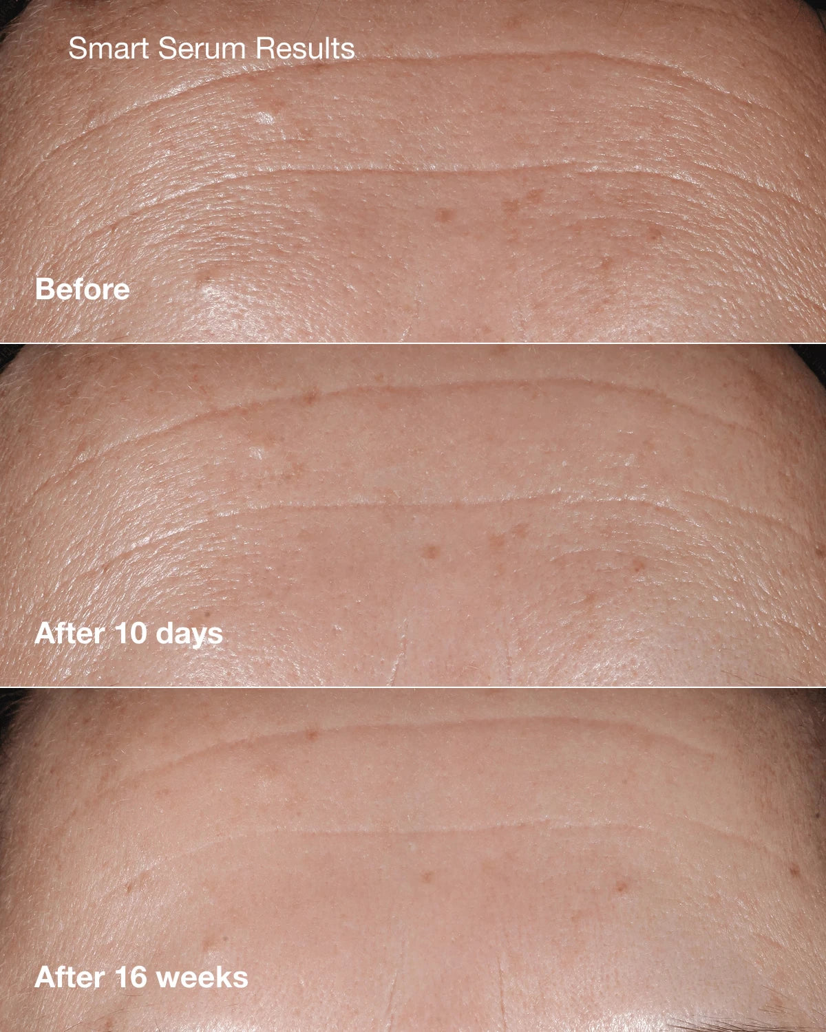 Anti-Aging Skincare Bundle - US 9914