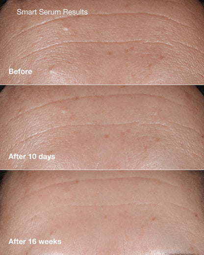 Anti-Aging Skincare Bundle - US 9914