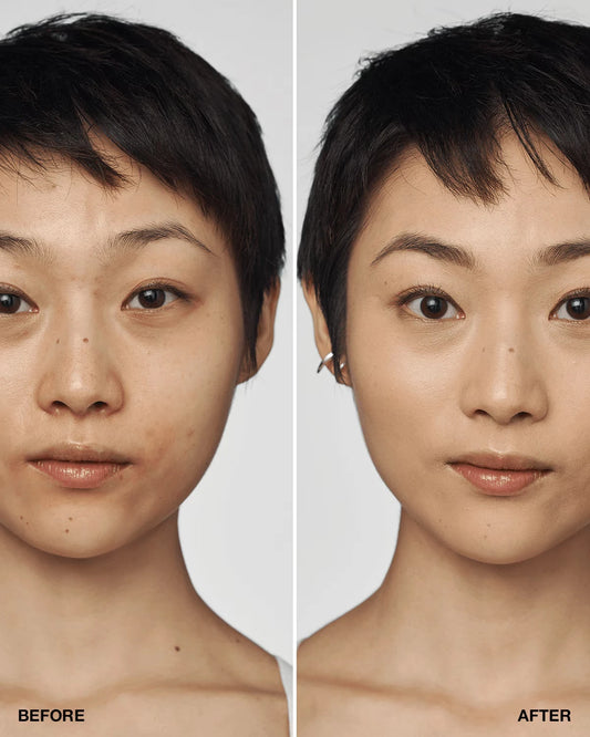 Even Better Clinical™ Serum Foundation Broad Spectrum SPF 25 - US 2904