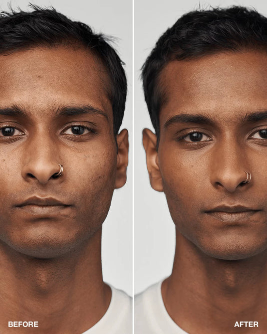 Even Better Clinical™ Serum Foundation Broad Spectrum SPF 25 - US 6125